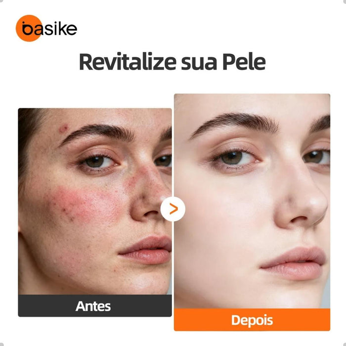 Aparelho de Mesoterapia Facial e Corporal Basike MRY 358 Radiofrequência Quente e Fria Bivolt Basike